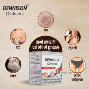 Dennison-Ointment-Post-5-600x600